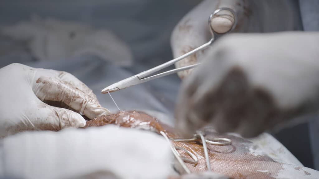 Cirugía Reconstructiva Genital Agrandamiento de pene engrosamiento de pene alargamiento de pene